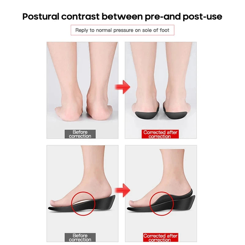 Orthopedic Arch Support